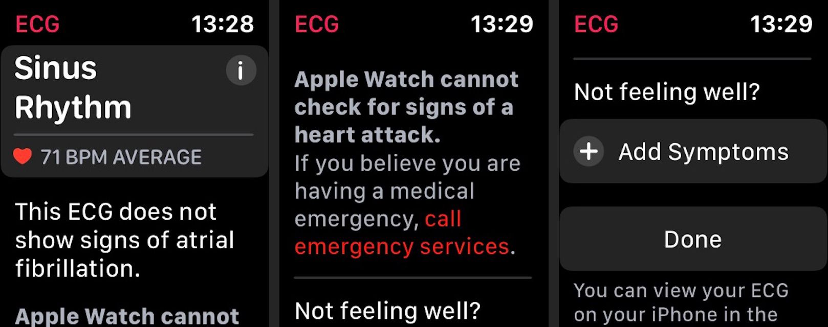 Resultados de ECG do Apple Watch