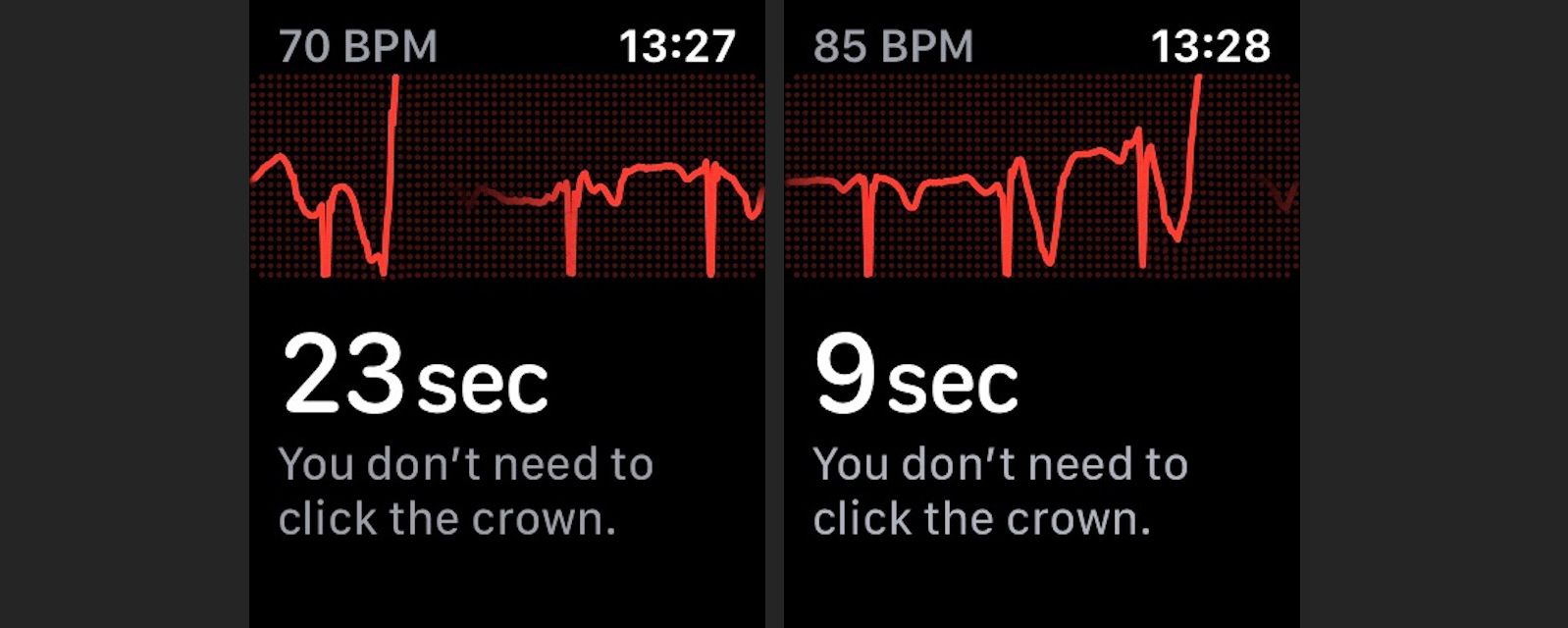 O aplicativo de ECG faz uma contagem regressiva de 30 segundos