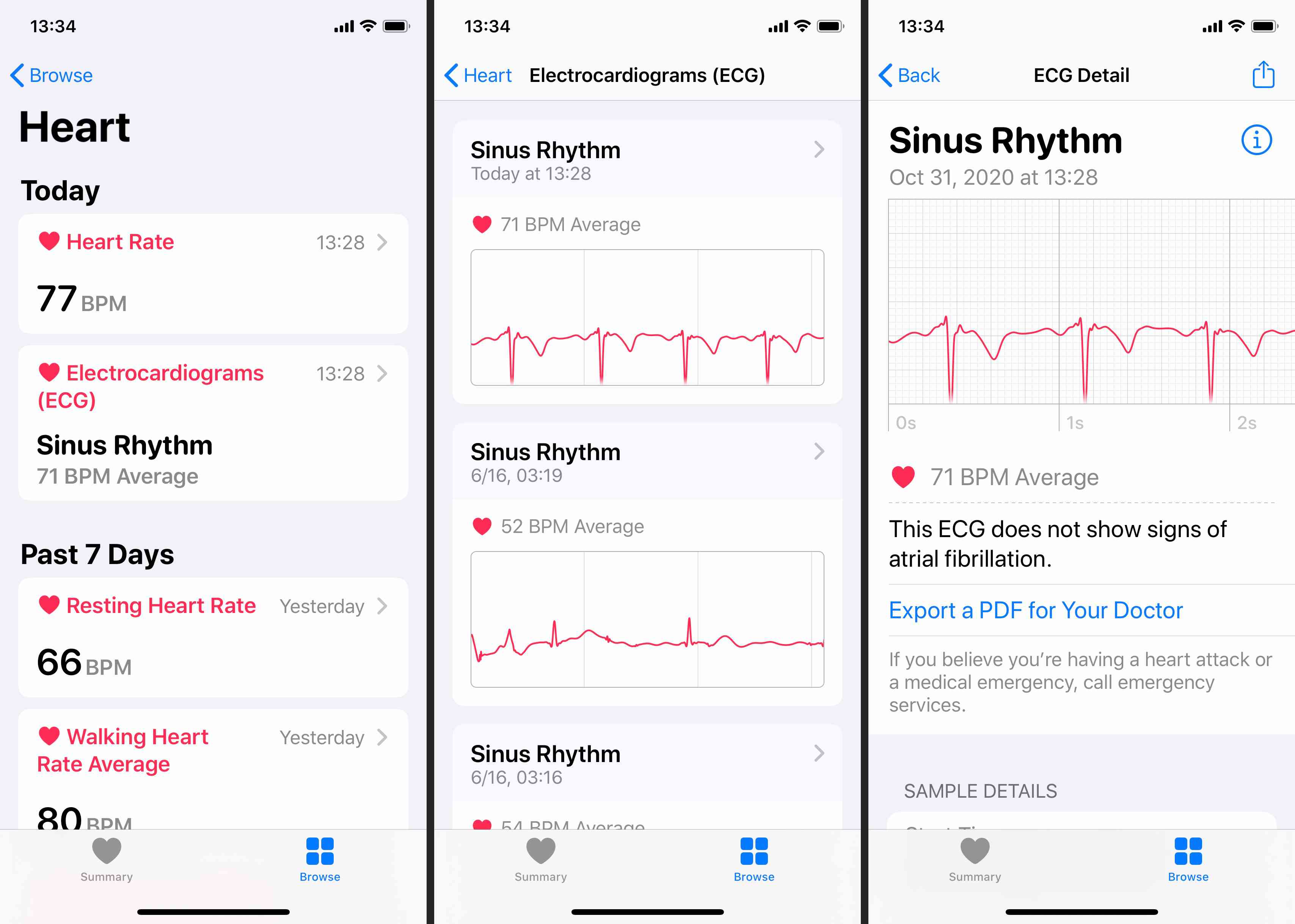 Você também pode ver os resultados do ECG no aplicativo Saúde do iPhone emparelhado.