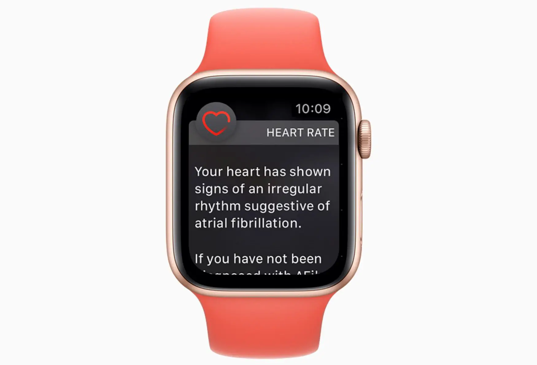 Um Apple Watch com uma notificação AFib de frequência cardíaca